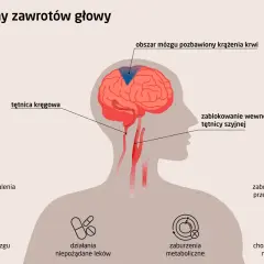 Zablokowanie tętnicy szyjnej lub kręgowej może powodować dziwne uczucie w głowie i oczach, a także inne problemy zdrowotne.