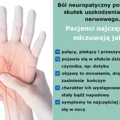 Dłoń z zaznaczonymi nerwami, ilustrująca ból neuropatyczny. Objawy to pieczenie, mrowienie, drętwienie, często nasilające się w nocy.