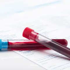 Anemia a psychika: Rozpoznaj objawy, odzyskaj spokój