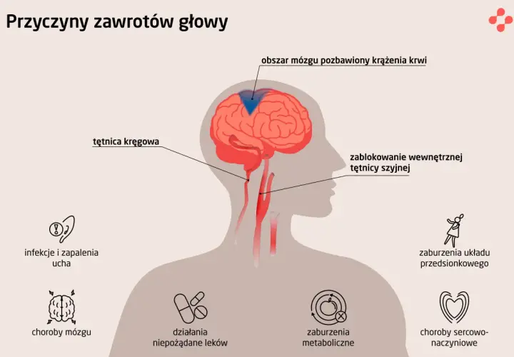 Zablokowanie tętnicy szyjnej lub kręgowej może powodować dziwne uczucie w głowie i oczach, a także inne problemy zdrowotne.
