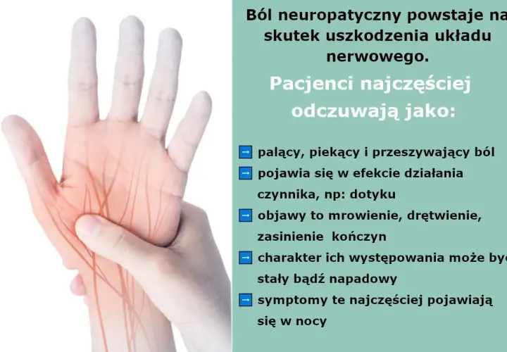 Dłoń z zaznaczonymi nerwami, ilustrująca ból neuropatyczny. Objawy to pieczenie, mrowienie, drętwienie, często nasilające się w nocy.
