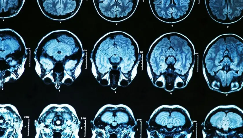 Parkinson: Psychiczne aspekty zrozum, lecz, żyj lepiej