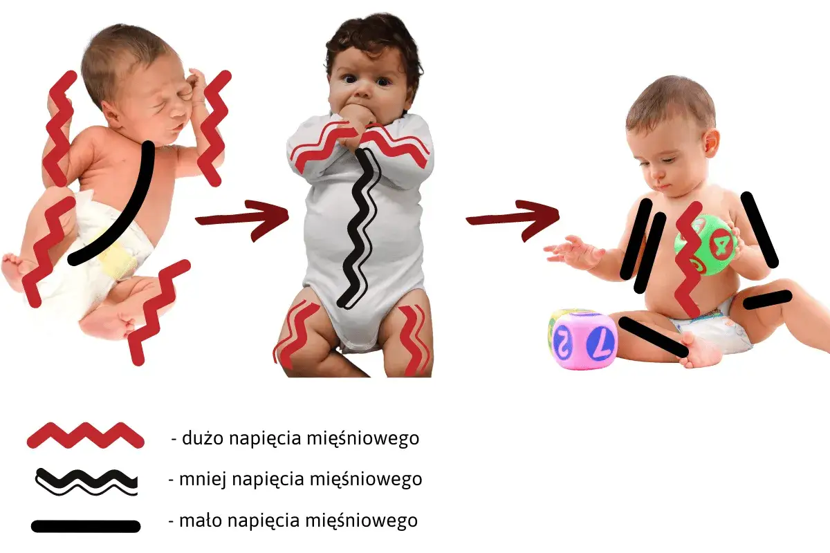 Dziecko z dużą złością i napięciem mięśniowym, przechodzące do mniejszego napięcia i spokoju.